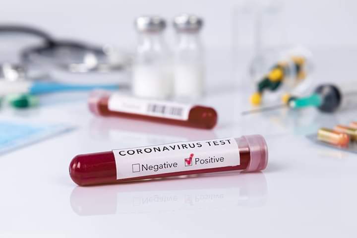 TEST SIEROLOGICI COVID-19 