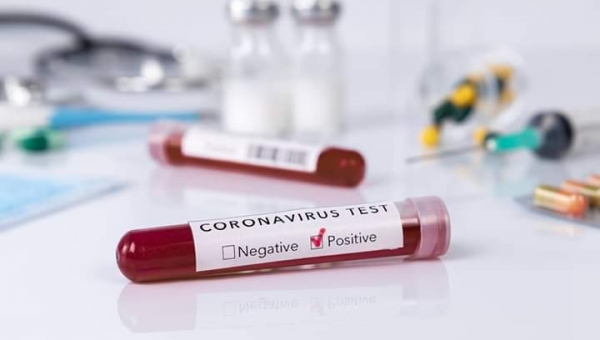 TEST SIEROLOGICI COVID-19 